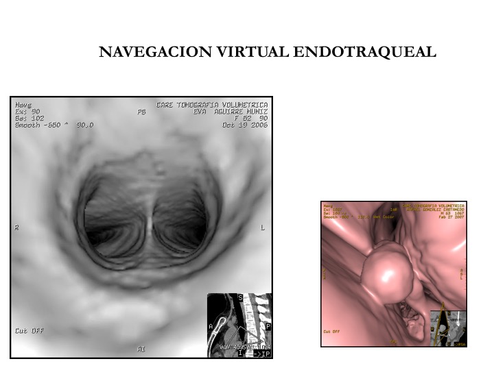 Tomografías de la cabeza