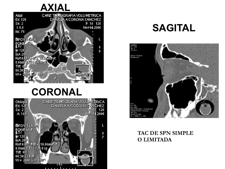 Tomografías Axial y Sagital