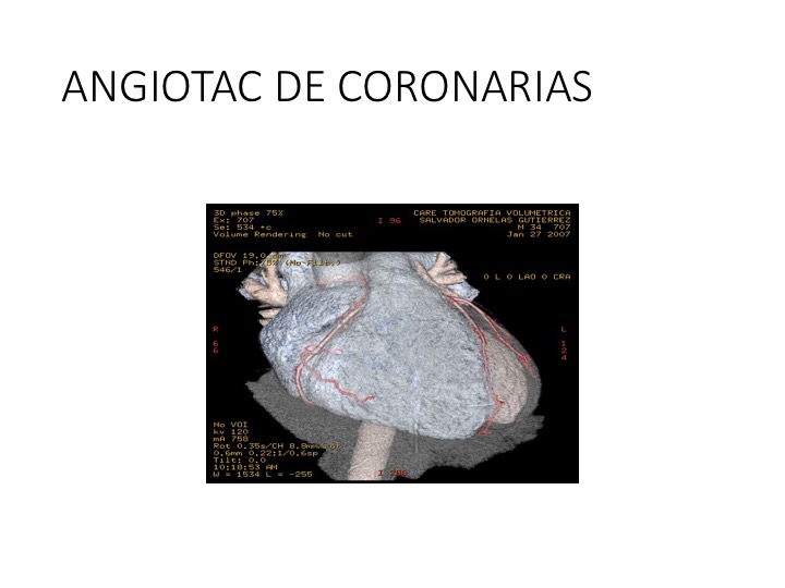 Tomografías de la cabeza