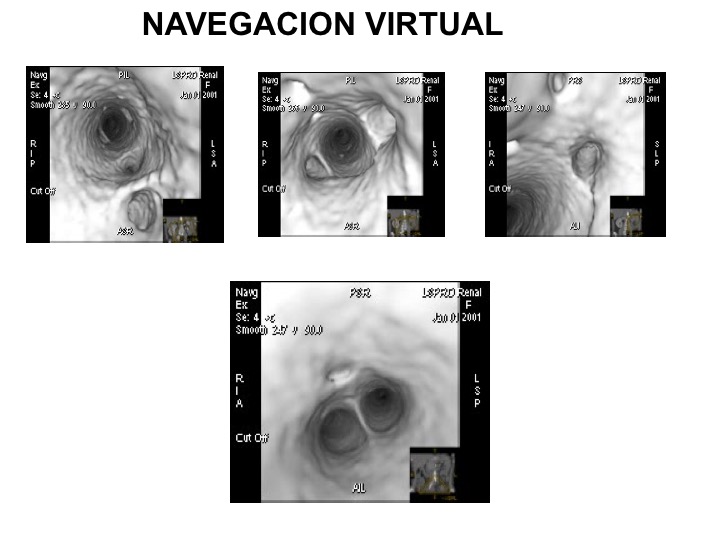 Tomografías de la cabeza