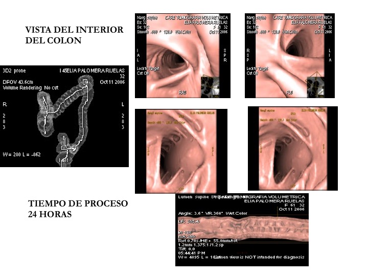 Tomografías de la cabeza