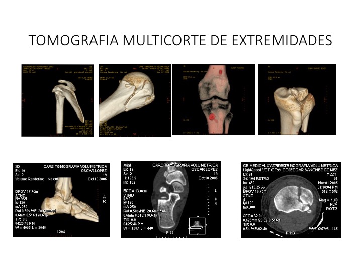 Tomografías de la cabeza