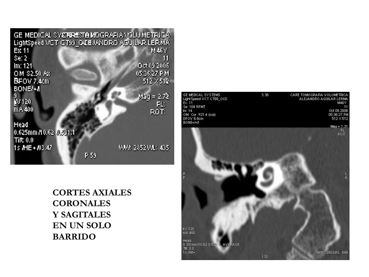 Cortes axiales y sagitales